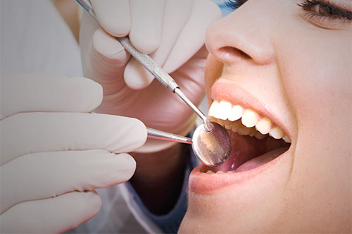 Benefits of regular dental cleanings at South Anchorage Dental Center