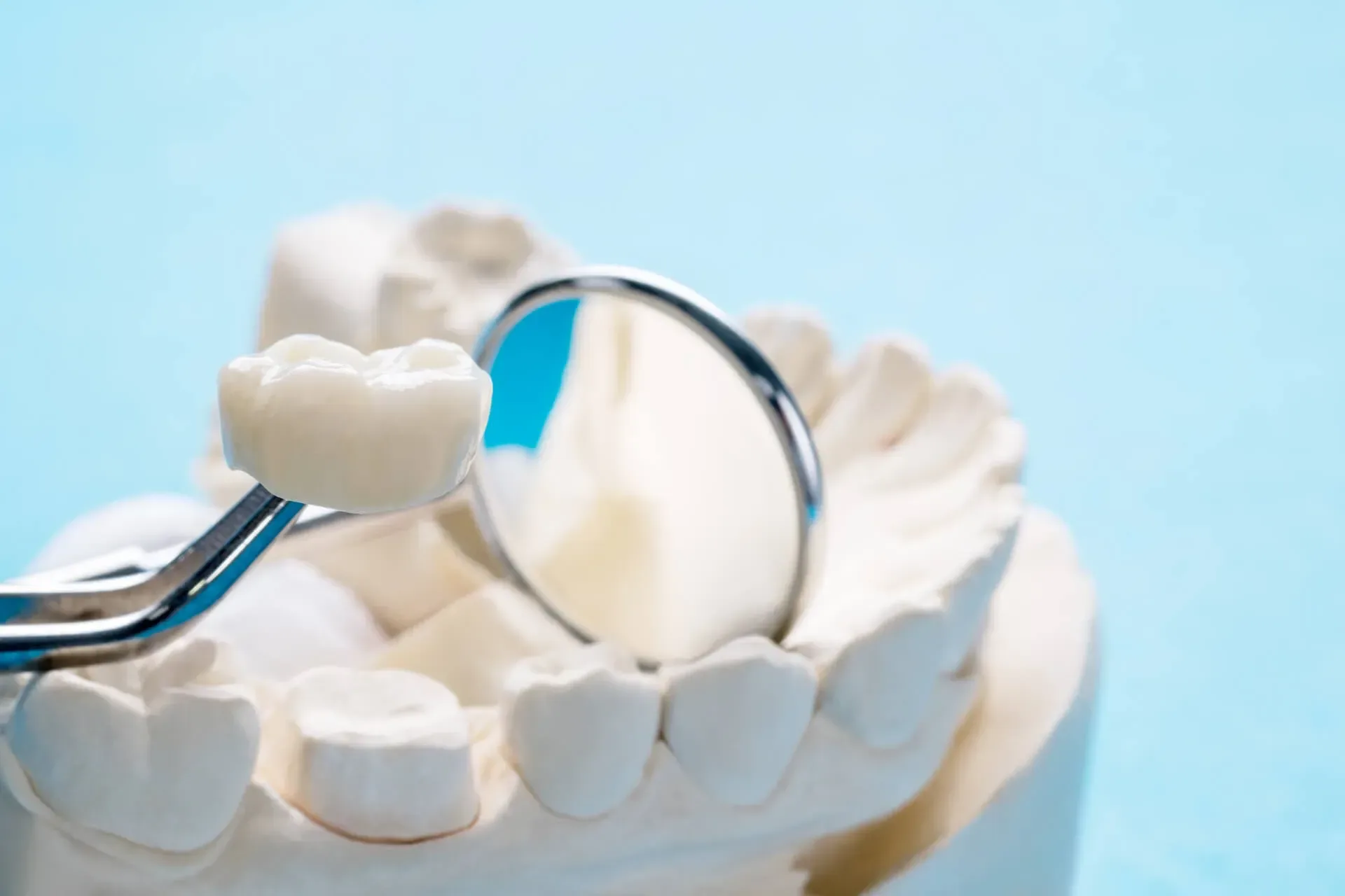 Same Day Dental Crowns at South Anchorage Dental Center