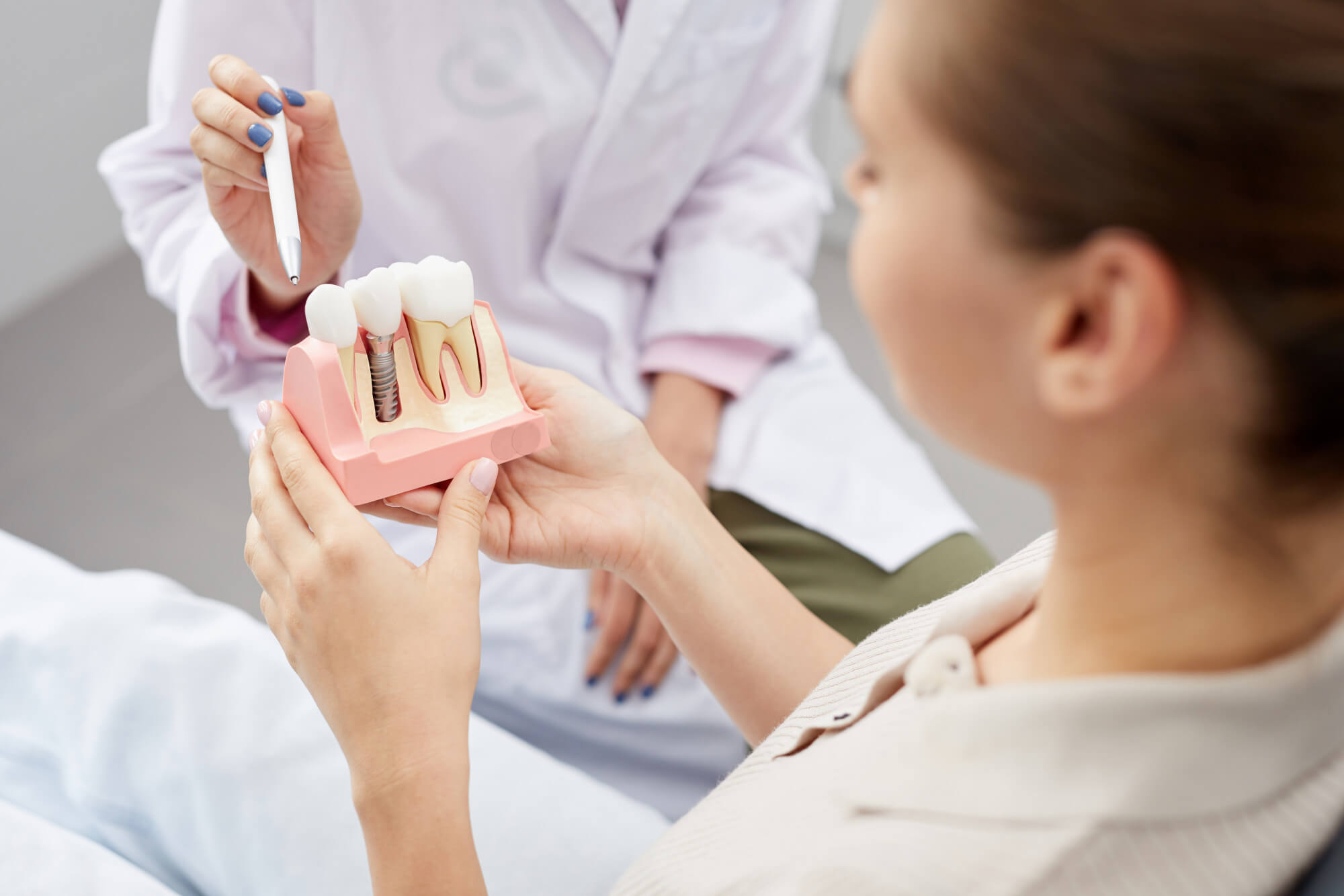 Dental implant process at South Anchorage Dental Center