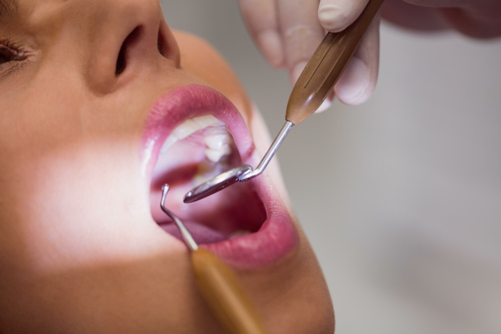 Gum Disease Treatment at South Anchorage Dental Center